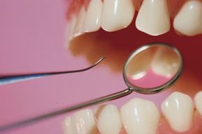 A dental pick can help remove plaque and food particles from your teeth.
