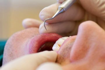 dental procedure