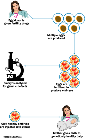 preimplantation genetic diagnosis