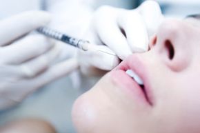 Woman receiving facial filler injection.