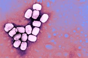 In 1999, the World Health Organization set a deadline for the United States and Russia to destroy their remaining stockpiles of smallpox, but as of yet they haven't complied.