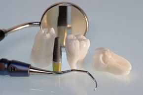 Is using dental instruments to give youself a cleaning a good way to save  money or plane crazy?