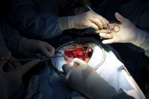 胸骨骨折是心脏直视手术的标准程序，现在可以用胶水修复。