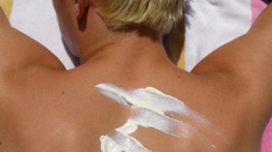 Does tanning lotion work?