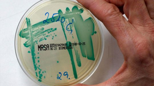 Can drug-resistant bacteria lose their resistance?