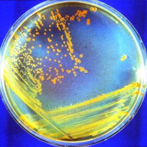D. radiodurans is hardier than any human astronaut we'll likely send into space. These bacteria could survive life on another planet.
