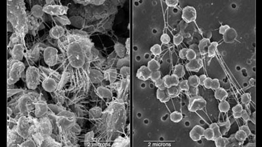 18新利最新登入极端微生物是如何工作的”border=