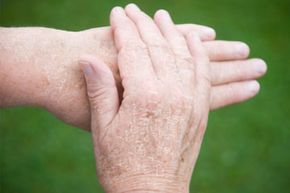 Hands of a 50-year-old- caucasian woman, close-up.