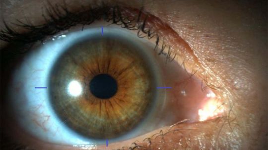 The Eyes Have It: Scientists 3-D Print Human Corneas