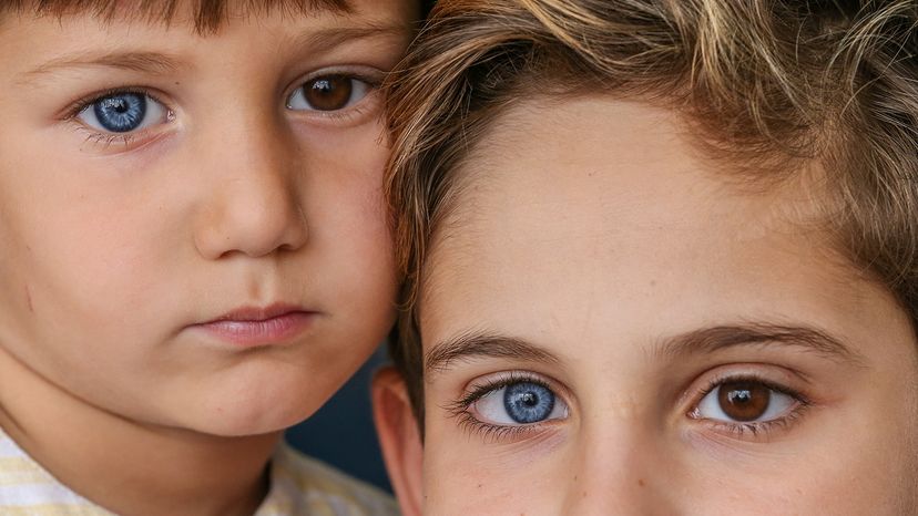 brothers with heterochromia iridis