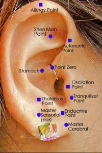 Some believe that an ear staple will suppress a person's appetite.