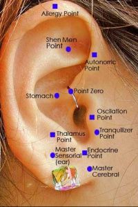 Acupressure Slimming Ear Cuff Set Of 2 For Weight Loss, Non