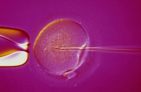 A successful pregnancy requires a healthy egg. This egg is being fertilized through Intracytoplasmic Sperm Injection (ICSI). Learn more from our pregnancy pictures.