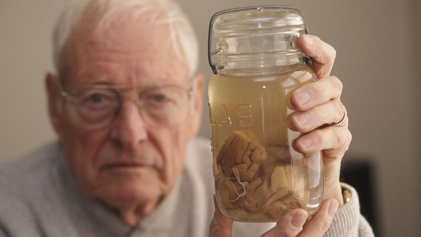 Thomas Harvey holds a jar with Einstein's brain in it.