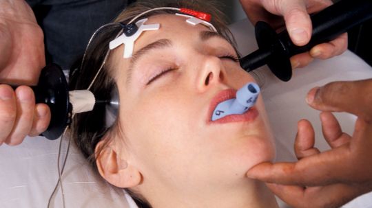 How Electroconvulsive Therapy Works