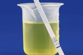 The hormone hCG is extracted from the urine of pregnant women.