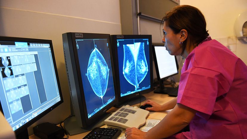 Dr. Rim Villard, mammogram