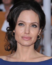 Angelina Jolie's lips are the gold standard for many women getting plastic surgery.