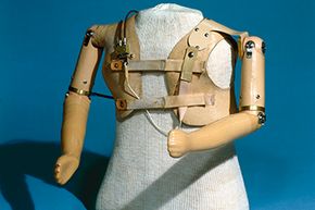 This upper limb prothesis was created for children exposed to the drug thalidomide in utero.