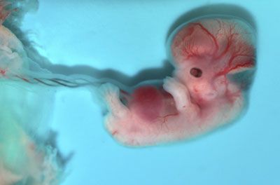 fetus 8 weeks