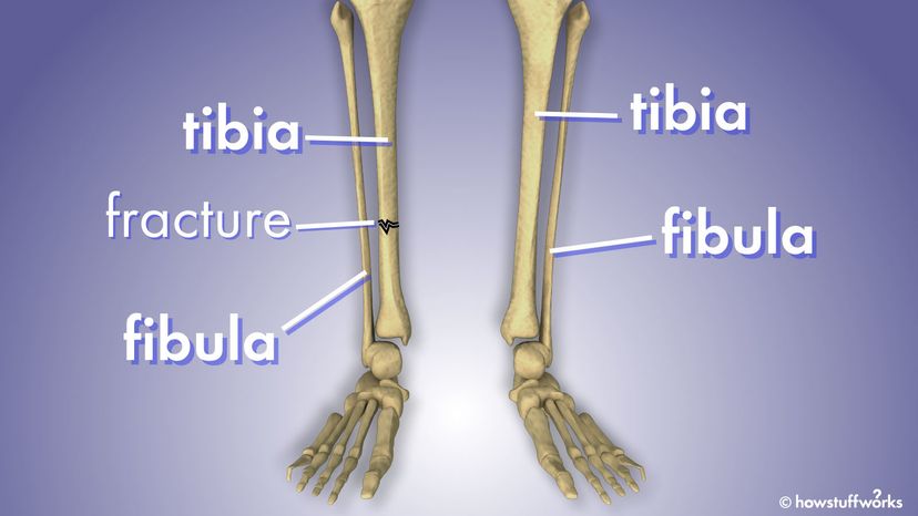 fibula and tibia