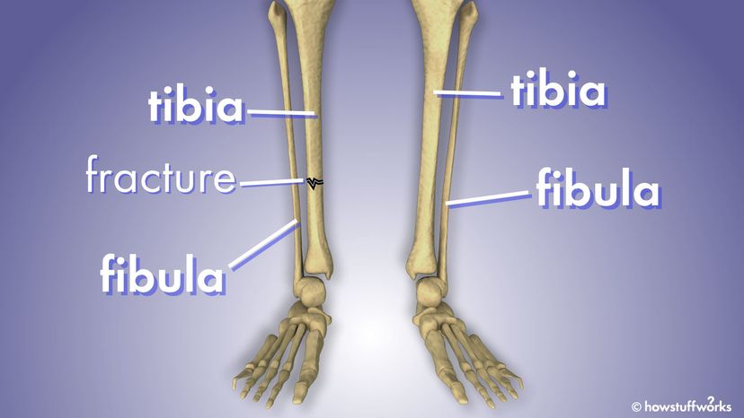 腓骨和胫骨＂width=