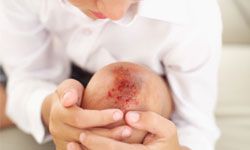 elevated view of a boy looking at his cut and bruised knee