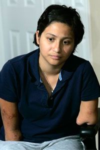 Claudia Mejia contracted flesh-eating bacteria before giving birth to her son. Mejia underwent amputation surgeries to save her life.