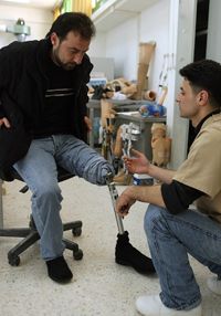 Flex funds can be used to pay for prosthetics not covered by insurance.
