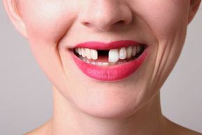 Close-up of adult's smiling teeth.