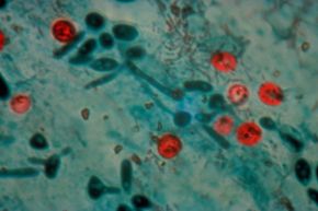 Cryptosporidium fungal cells