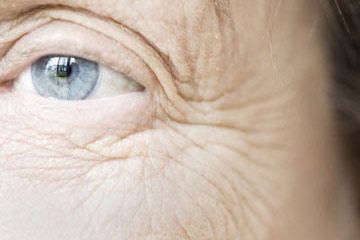 Close up of eye of elderly woman with apparent crows feet and wrinkles.