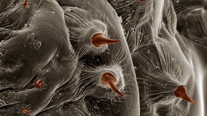 microscopic view of a human bot fly larva