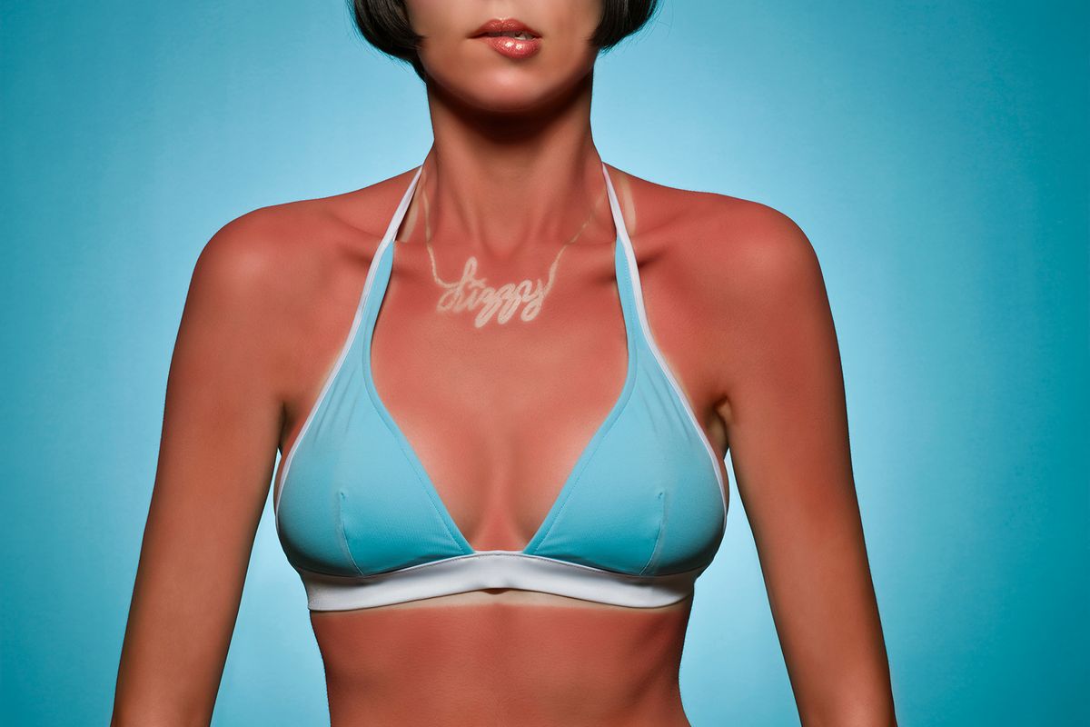 How Sunburn and Sun Tans Work