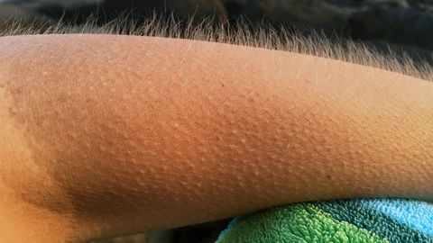 Why Do Certain Experiences Give Us Goosebumps? - Vimarsana News