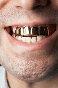This gold teeth grill brings new meaning (and flash) to the phrase &quot;megawatt smile.&quot;