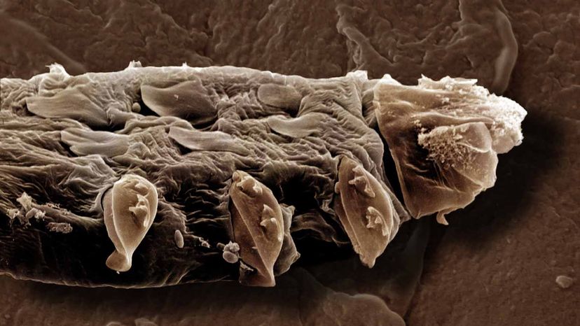 eye mites