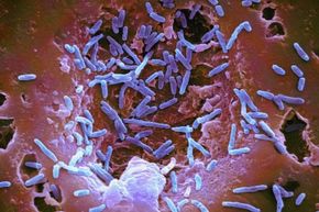 Say hello to a few residents of your body: Mycobacterium chelonae bacteria. They're normal flora in the guts and respiratory tracts of humans and other animals. They rarely cause gut or lung infections, but they can cause local infections.