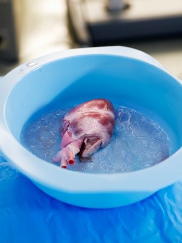 Heart in basin filled with ice in operating room