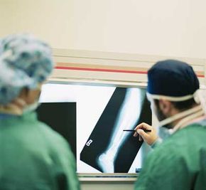 Two surgeons examine an x-ray of a broken leg.­