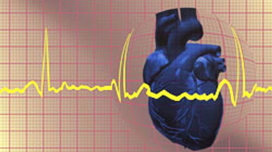 Coronary Heart Disease Overview