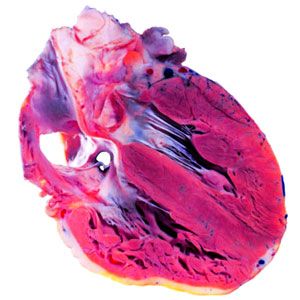 heart cross section
