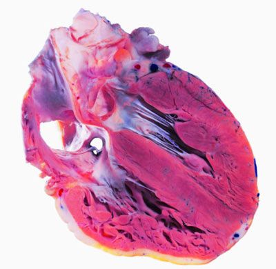 human heart