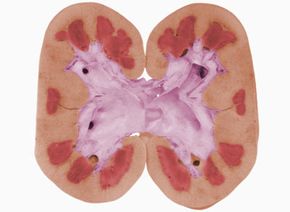 human kidney cross-section