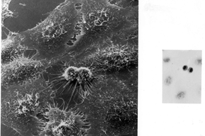 HeLa cells dividing