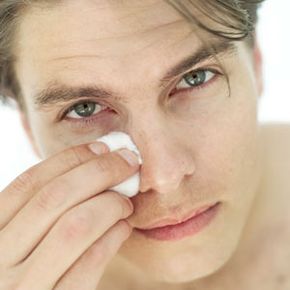 Young man with puffy skin under eyes.