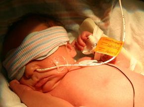 Babies born with cytomegalovirus may have jaundice, or yellowed skin, due to liver problems. Jaundice is usually treated with a light that helps to break down the bilirubin, a byproduct of the body's red blood cell production.