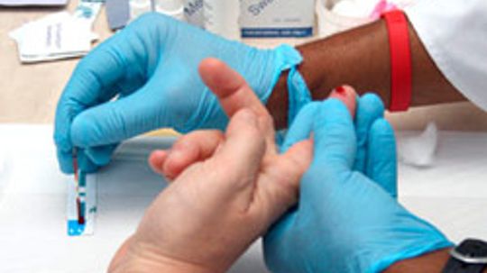 Wheat and Gluten Allergies HowStuffWorks