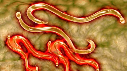 4 Signs You're Infected With a Parasite - Vimarsana News
