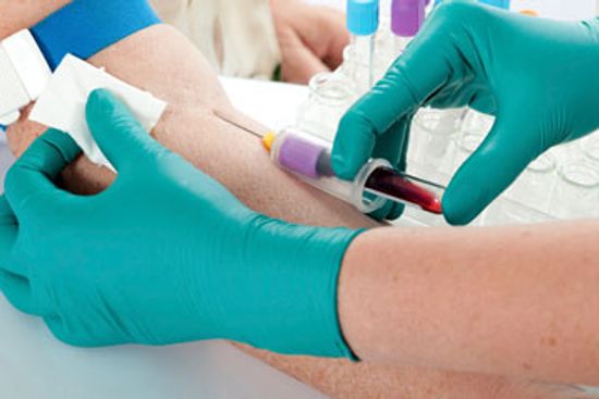 Hormone Imbalances and Infertility